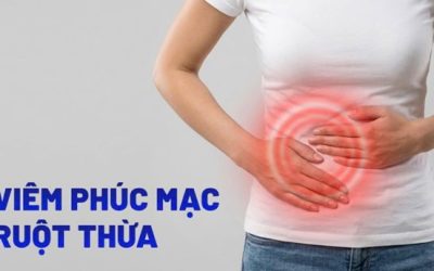 VIÊM PHÚC MẠC LÀ GÌ? NGUYÊN NHÂN, TRIỆU CHỨNG VÀ CÁCH ĐIỀU TRỊ CẤP CỨU