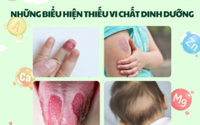 VAI TRÒ CỦA VI CHẤT TRONG DINH DƯỠNG CỦA TRẺ